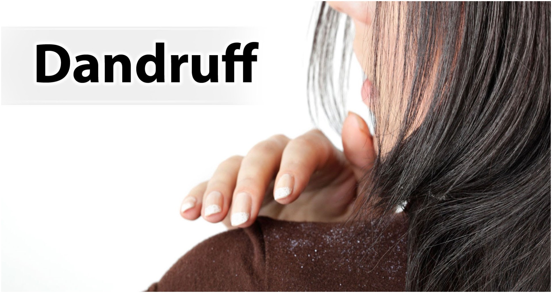 Hair Care Tips: इन देसी उपायों से डैंड्रफ को हमेशा के लिए अपने बालों से करें बाय-बाय, अपनाए ये सिंपल टिप्स
