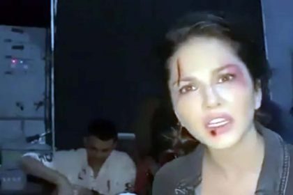 Sunny Leone Video: सनी लियोन के चेहरे पर चोट के निशान! वीडियो वायरल