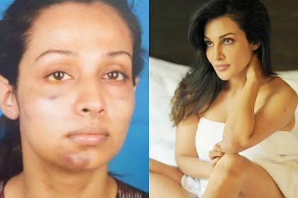 'Gandi Baat' fam actress Flora Saini sexually abused by boyfriend